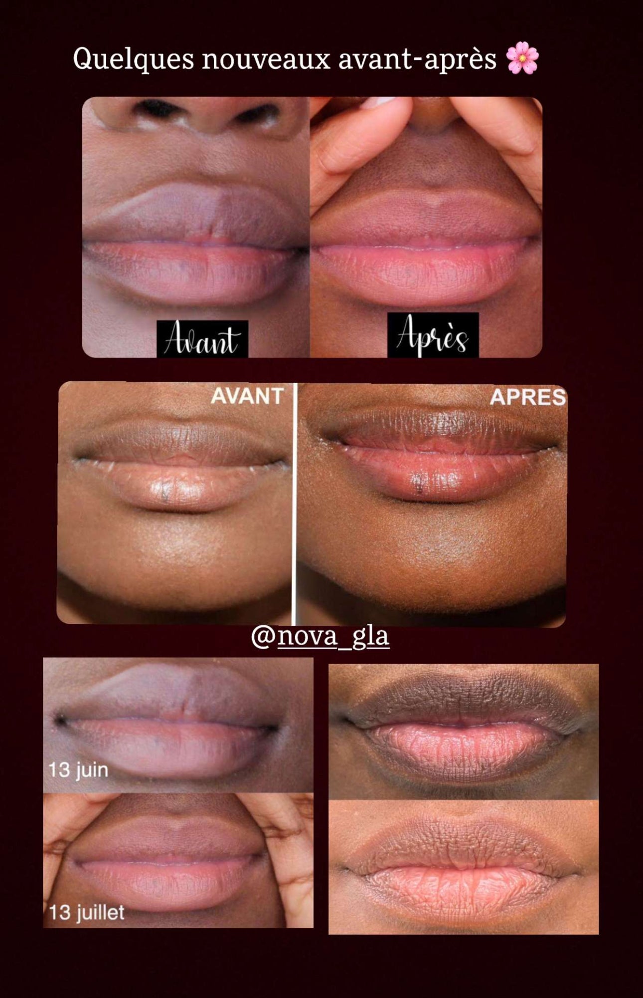 Brightening Lip Scrub